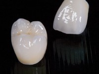 porcelaincrowns