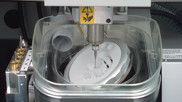 5 Axis milling allows us to create the most accurate crown yet.