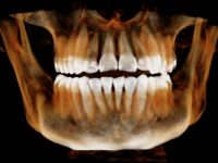 3D Xray